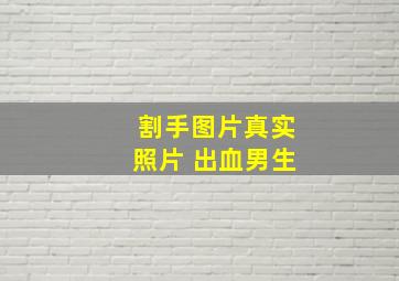 割手图片真实照片 出血男生